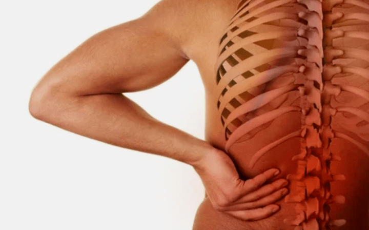 Příčiny osteochondrosy bederní